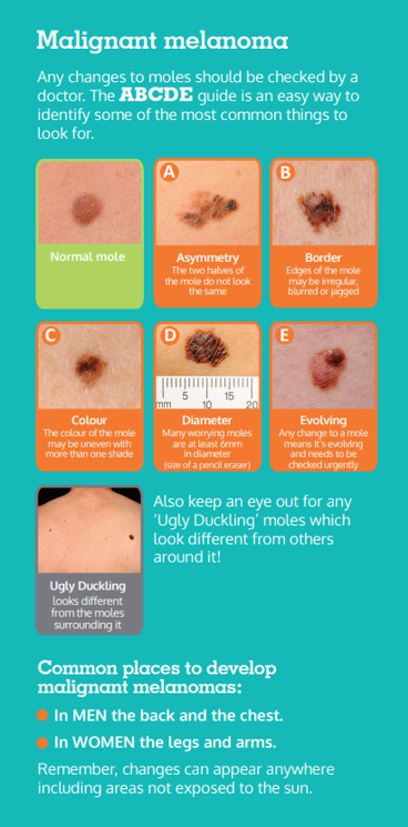 Signs and symptoms of skin cancer